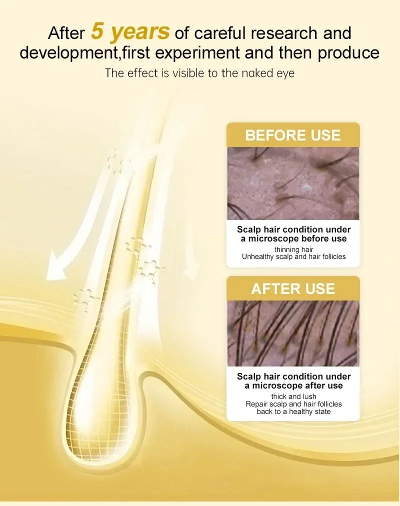 2024 Ginger Hair Growth Serum Sprayer Hair Regrowth s Grow Thicker Longer Hair Accelerate Growth For Men And Women